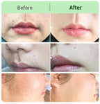 Hair Removal Cream