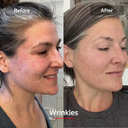 Megelin LED Red Light Therapy Face Mask