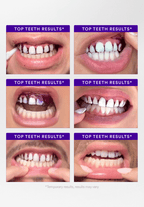 V34 Whitening Strips