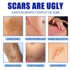 Scar Repair Cream for Men and Women, fade scars and tighten skin in one step