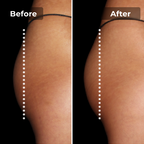 Megelin EMS Toning Shorts
