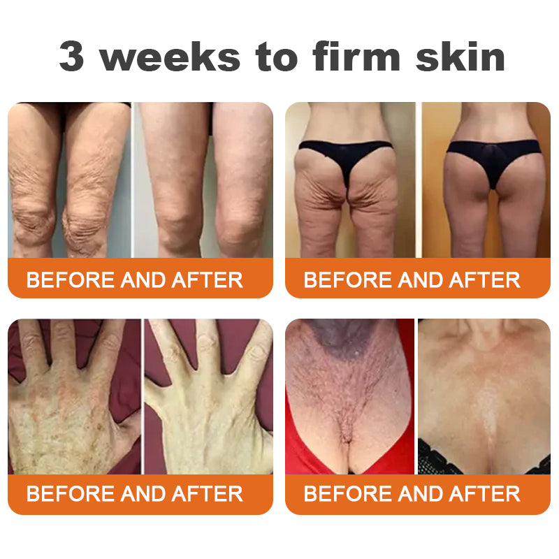 🧑‍⚕️𝑶𝒇𝒇𝒊𝒄𝒊𝒂𝒍 𝑺𝒕𝒐𝒓𝒆 | 𝐑𝐨𝐥𝐢𝐦𝐞𝐲® Botox Bee Venom Firming Serum Stick - Targets Sagging Skin & Wrinkles All Over Body with Advanced Peptide Technology, Visible Results in 3 Days (⏳LAST DAY 40% OFF)